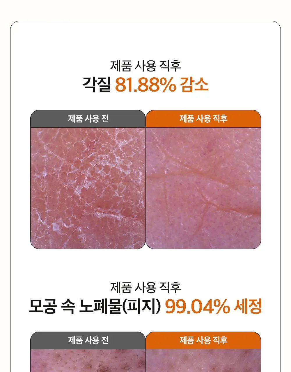 [블랙헤드 지우개] 파파레서피 블레미쉬 클렌징 오일 300ml 상세페이지 10